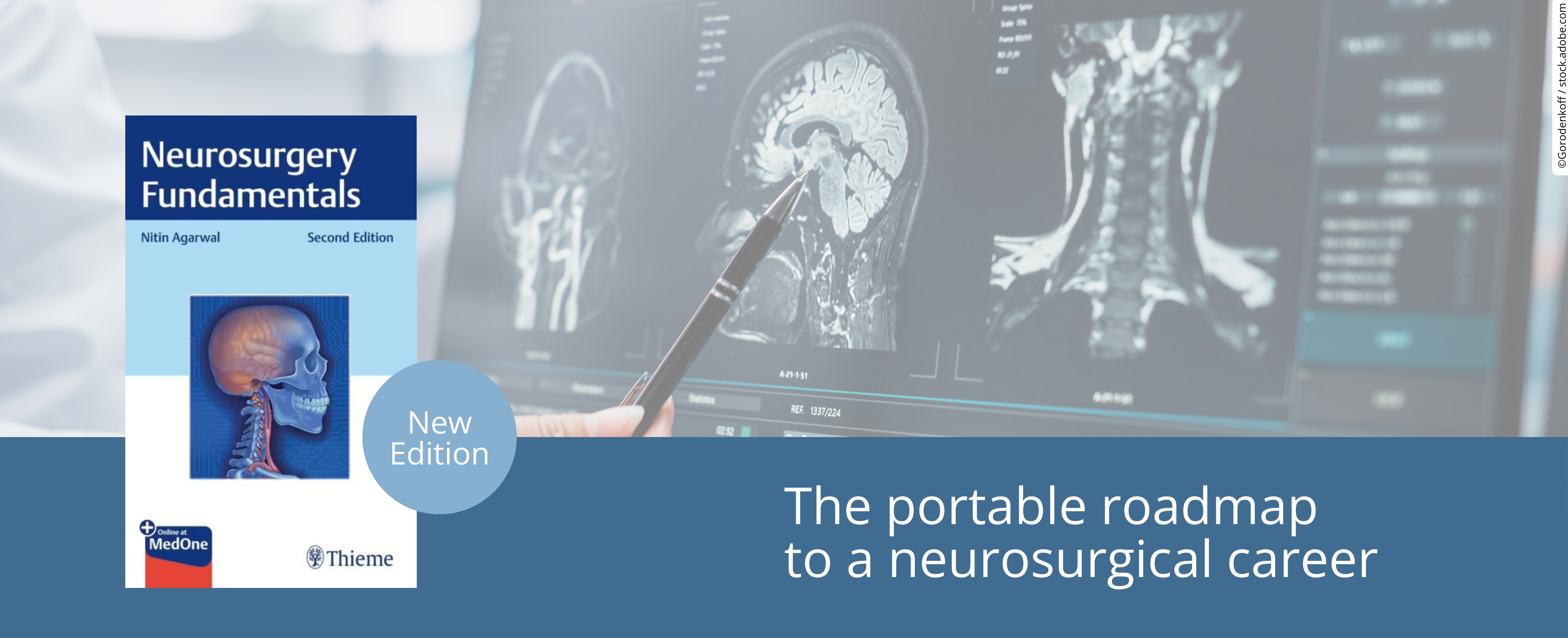 Neurosurgery Fundamentals
